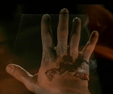 Paul's hand "burning"